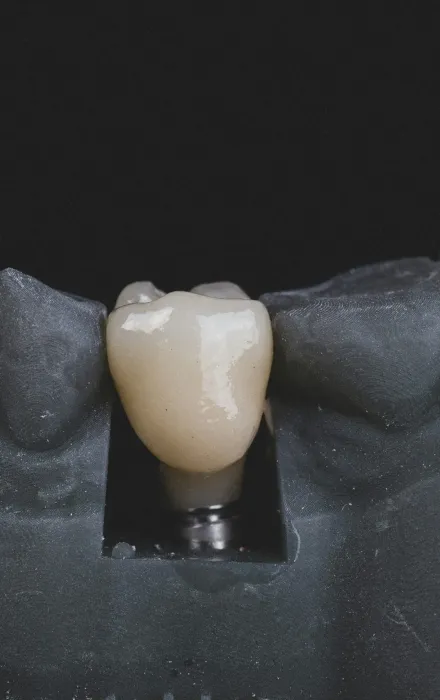 Korna na implancie dentiq kraków